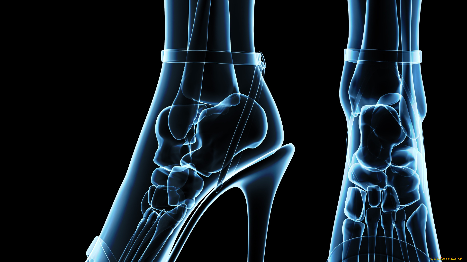 разное, кости, , рентген, каблуки