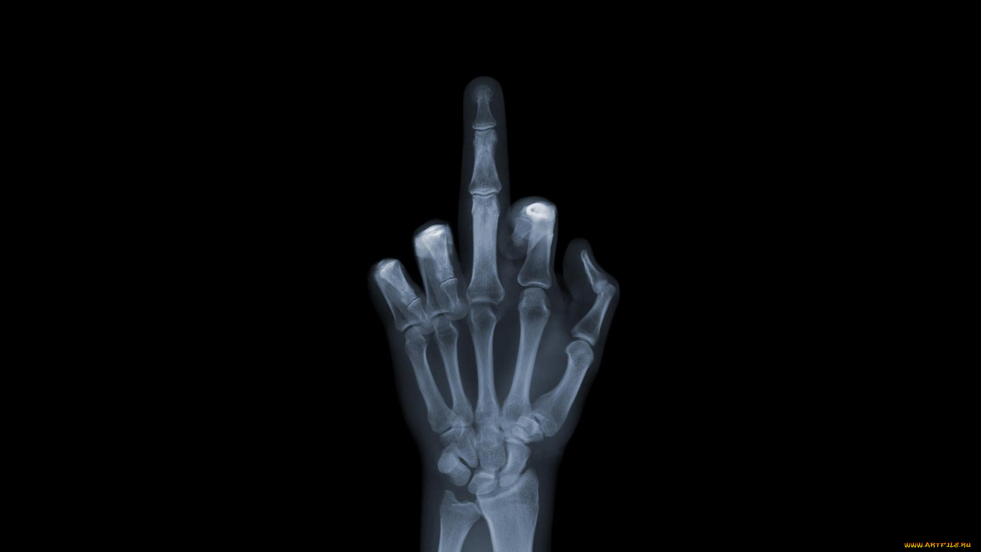 разное, кости, рентген, рука, fuck, you, фак, ю, снимок
