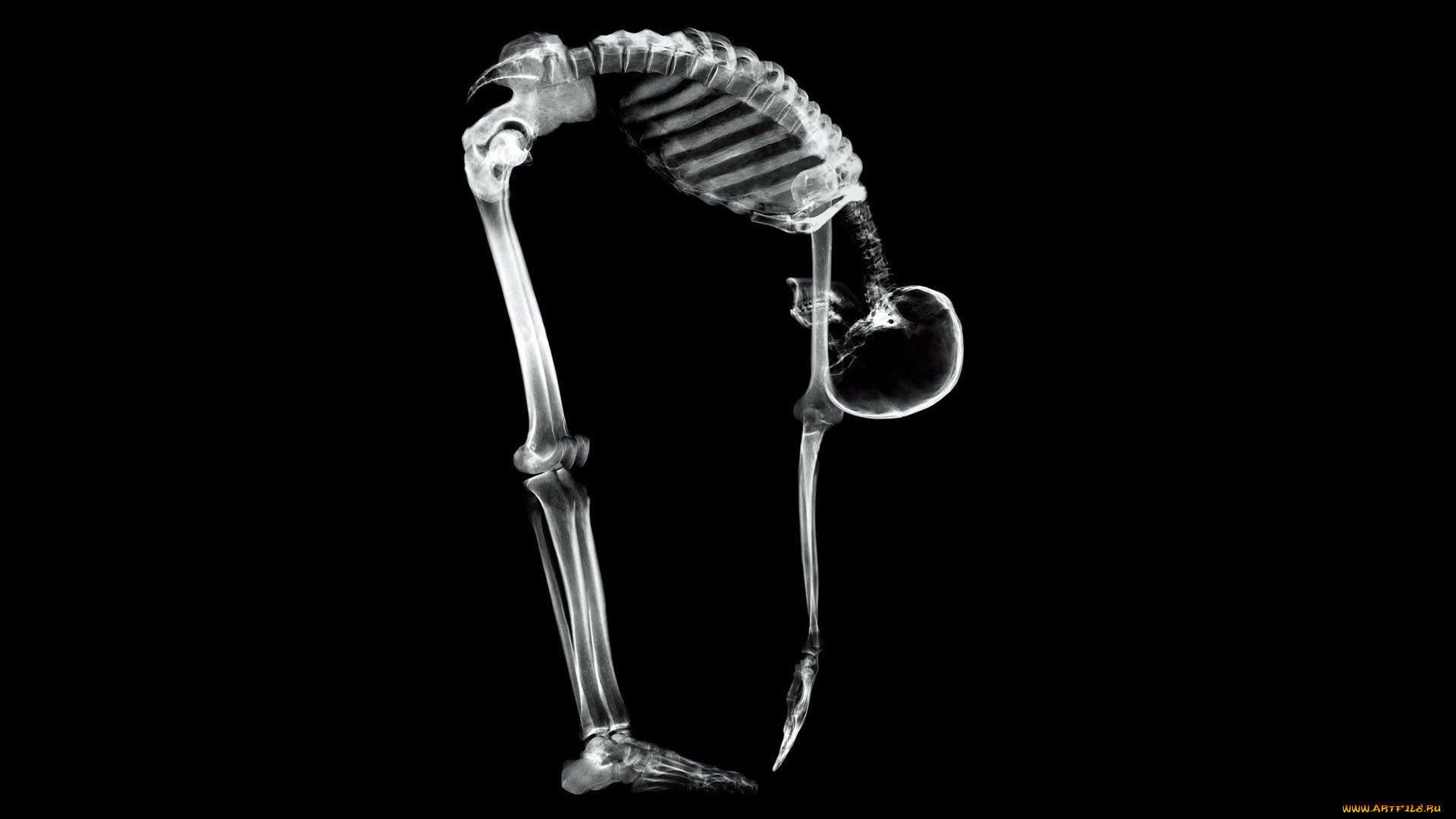 разное, кости, , рентген, скелет, человек, наклон