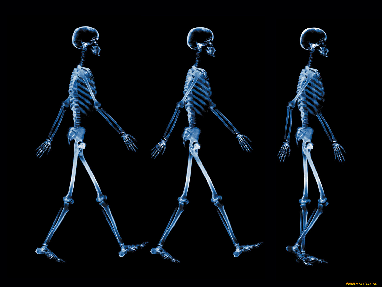 рентген02, разное