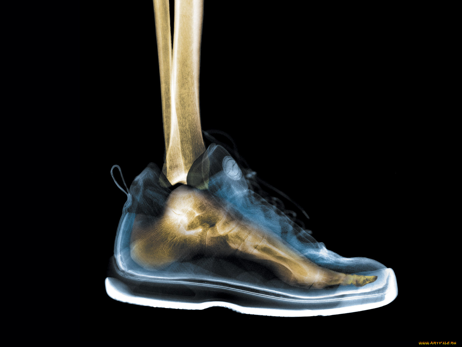 рентген, 08, разное, кости