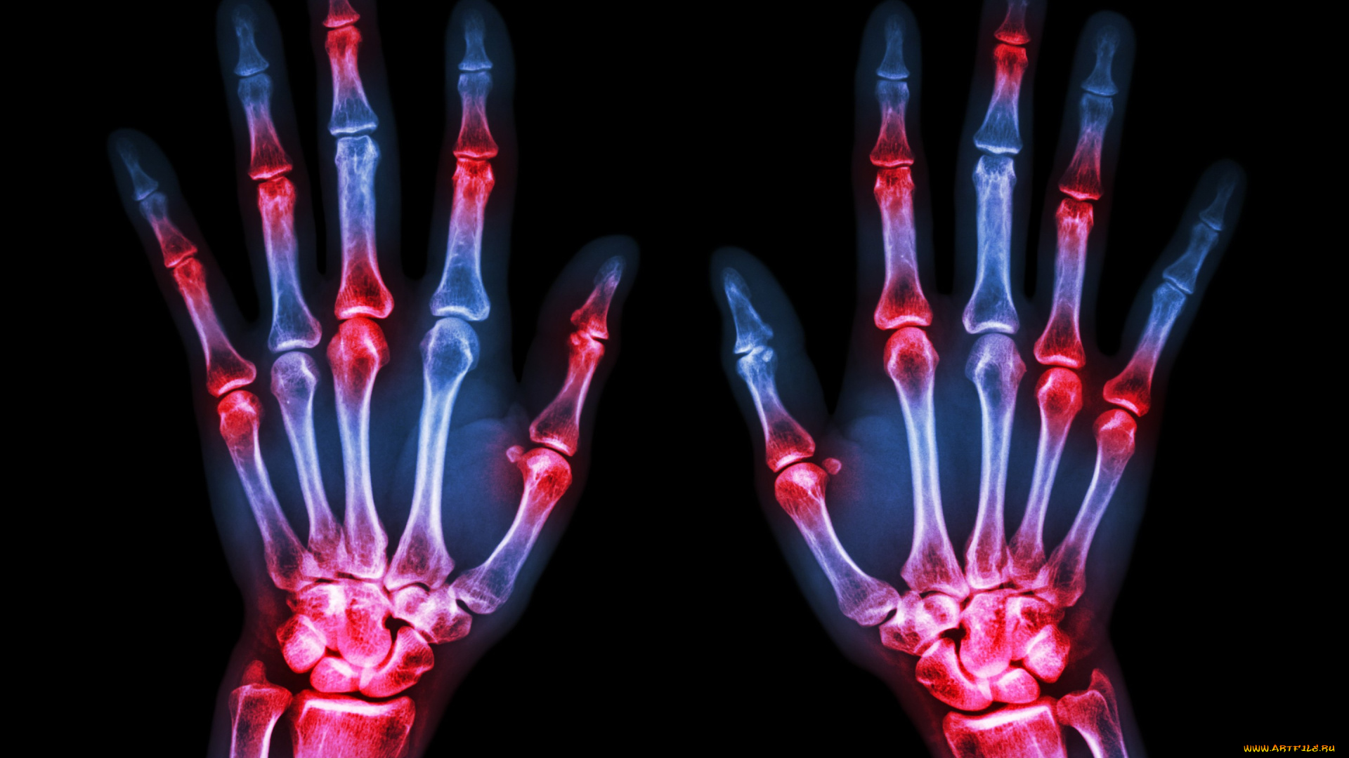 разное, кости, , рентген, рентген, фон, руки