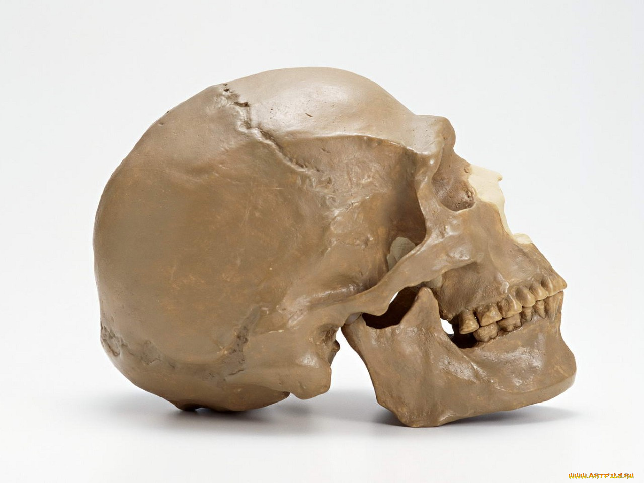 разное, кости, рентген