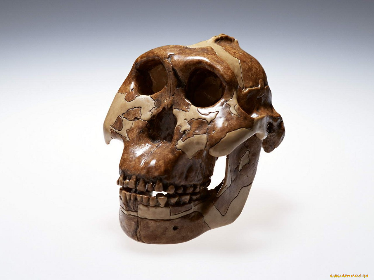 разное, кости, рентген