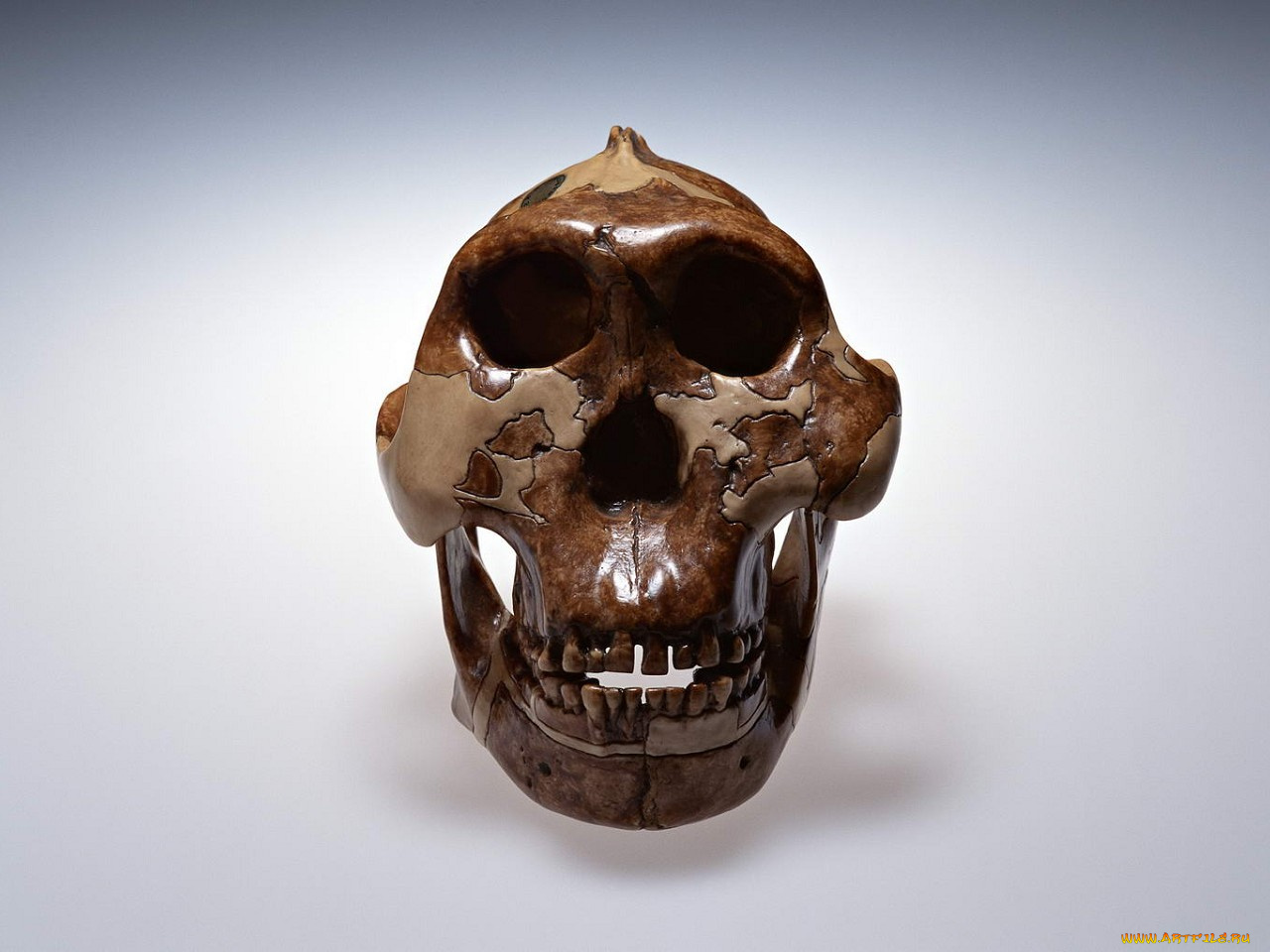 разное, кости, рентген