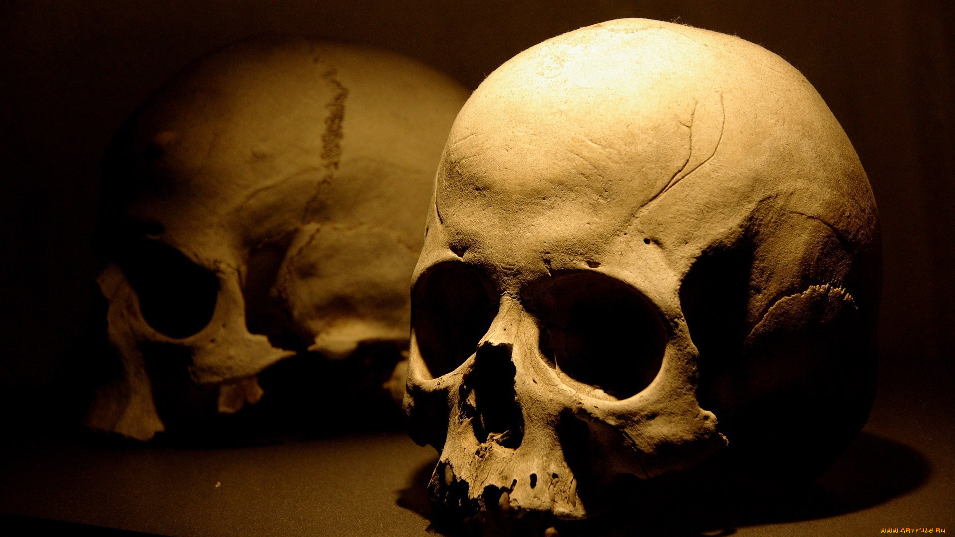 разное, кости, рентген