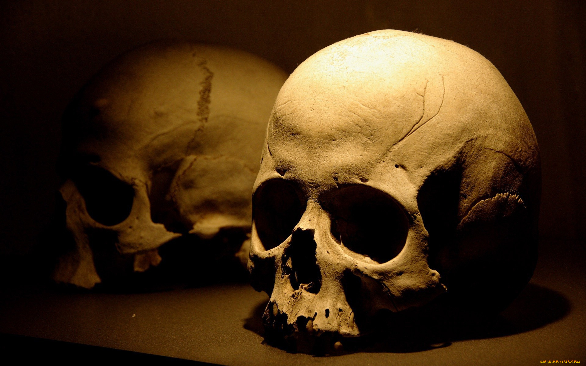 разное, кости, рентген