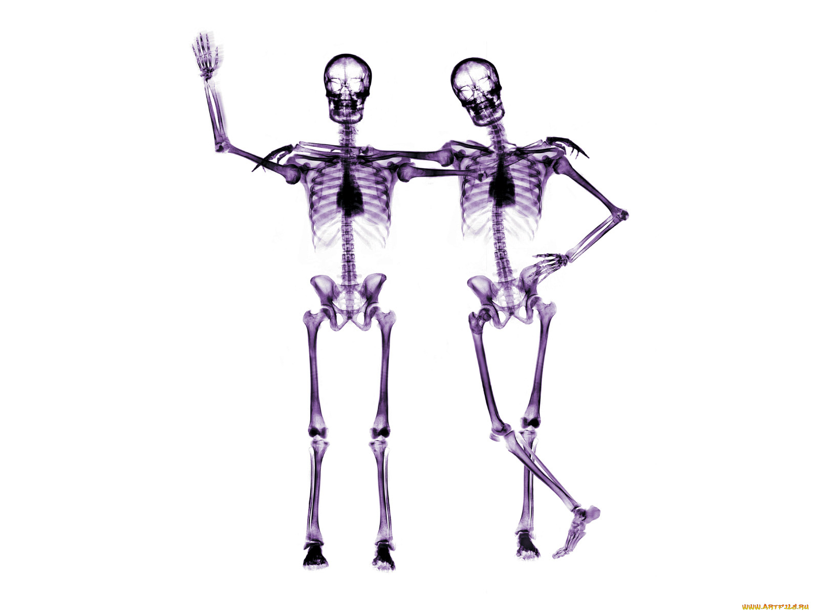 rentgen, 17, разное