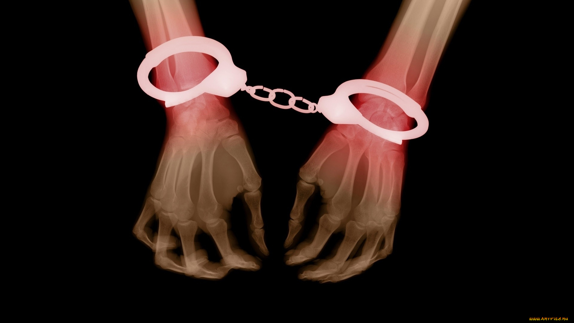 разное, кости, , рентген, руки, наручники