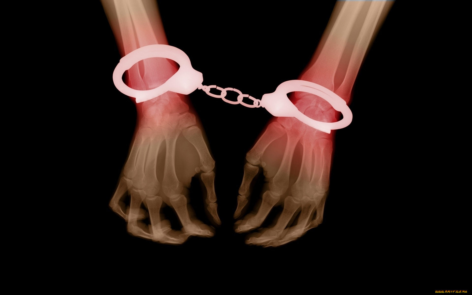 разное, кости, , рентген, руки, наручники